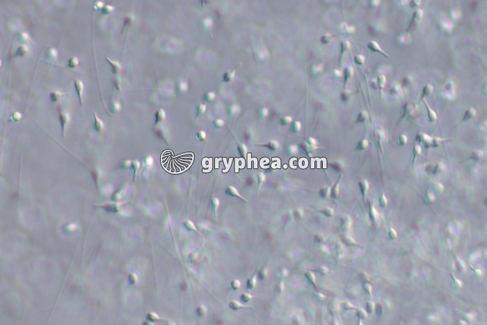 Spermatozoïdes de la Moule (Mytilus edulis) x125 - gryphea.org